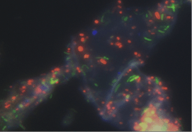 Bacteria on faecal fibre